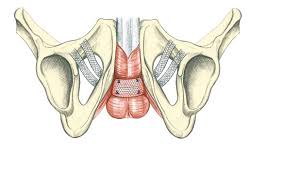 Image result for i-stop toms transobturator male sling