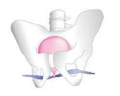 điều trị són tiểu ở phụ nữ